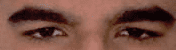 Eye area