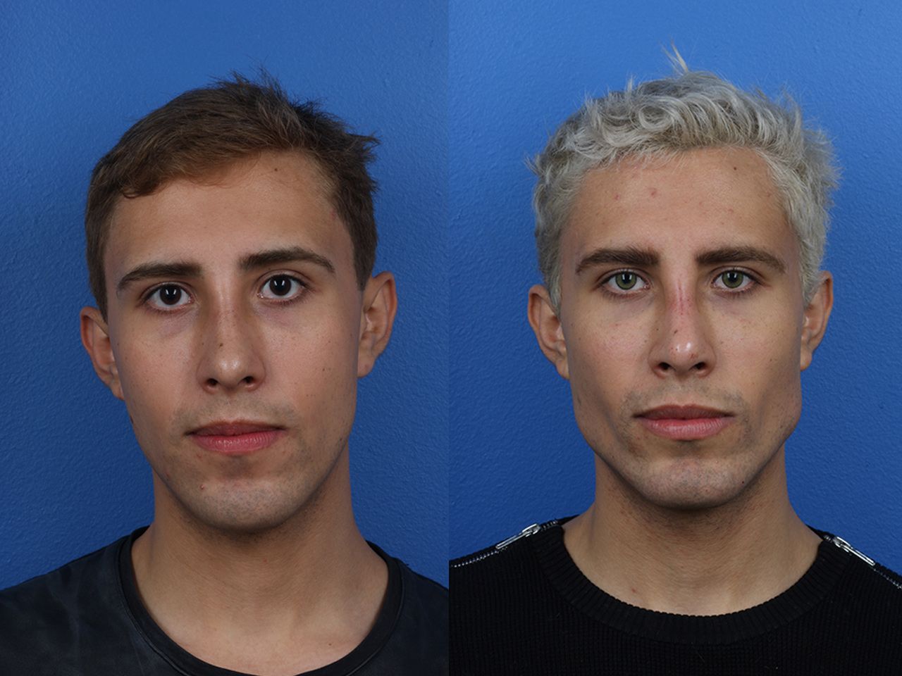 Beforeandafter Beforeandafter