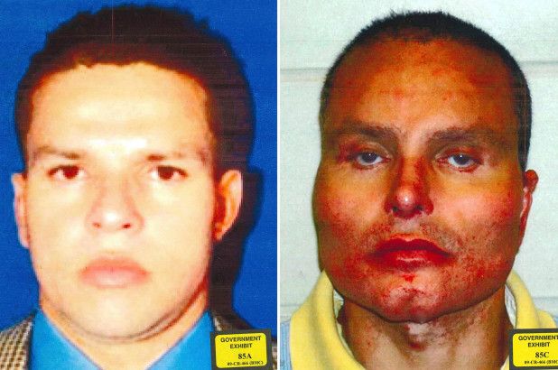 El chapo cocaine face off surgery El chapo cocaine face off surgery