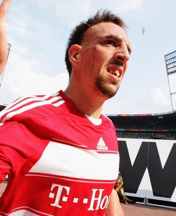 Franck ribery