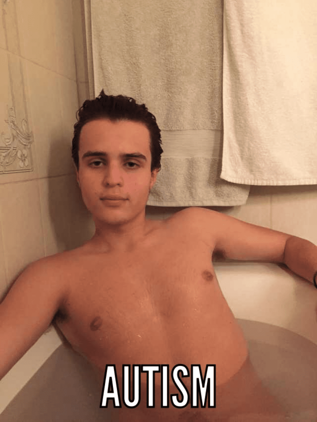 ApLE2ei