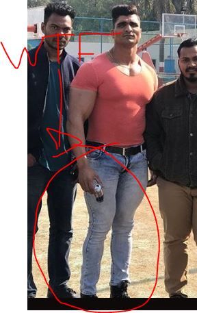 Leg