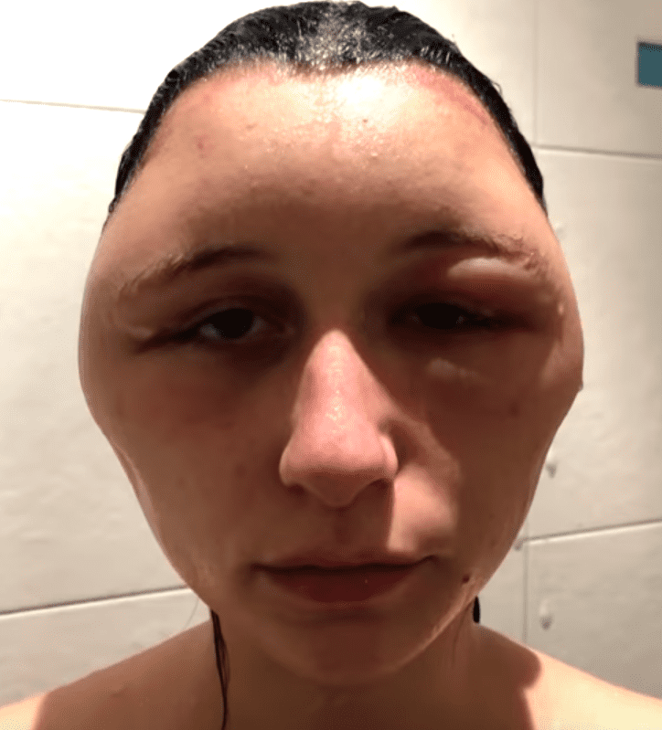 40379