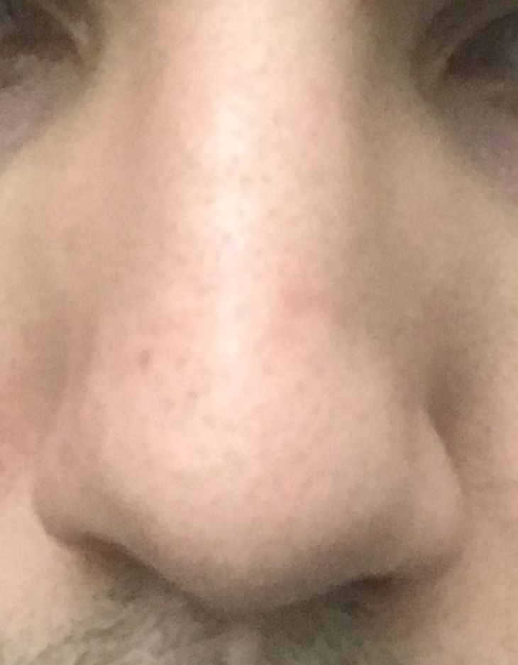 41435 41435