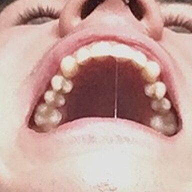 56296