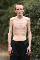 o-ANOREXIC-MARC-CORNS-570.jpg