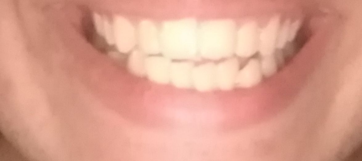 77110