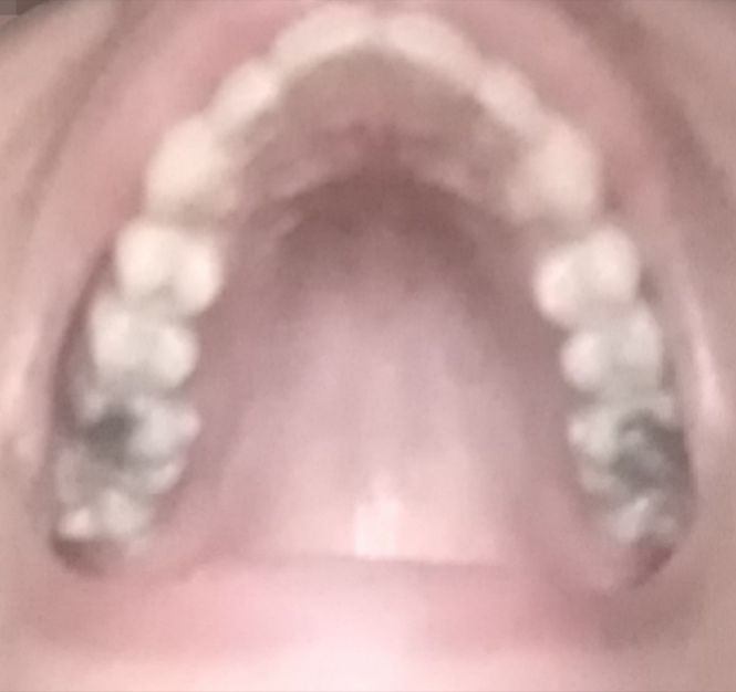 77111