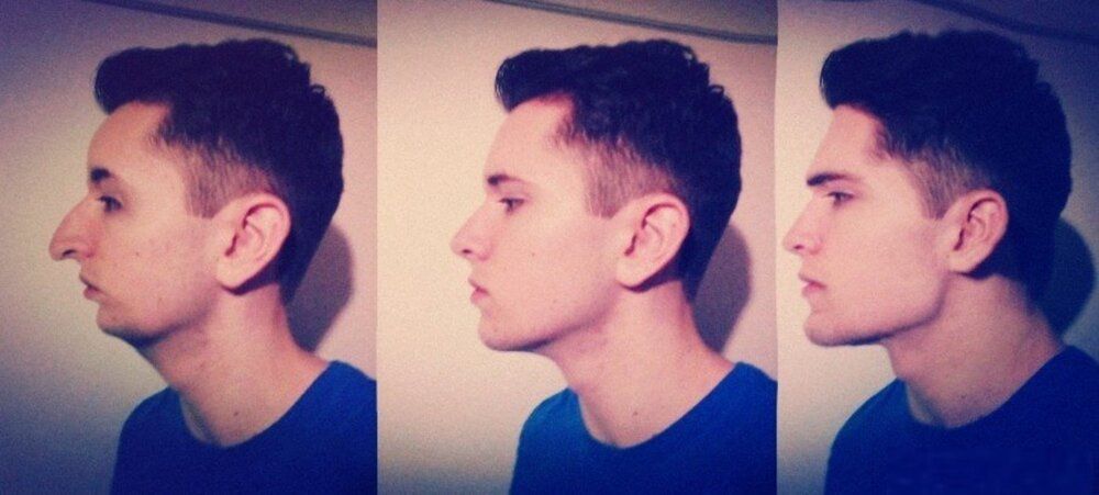 Chiselled Jawline | Looksmax.org - Men's Self-Improvement & Aesthetics