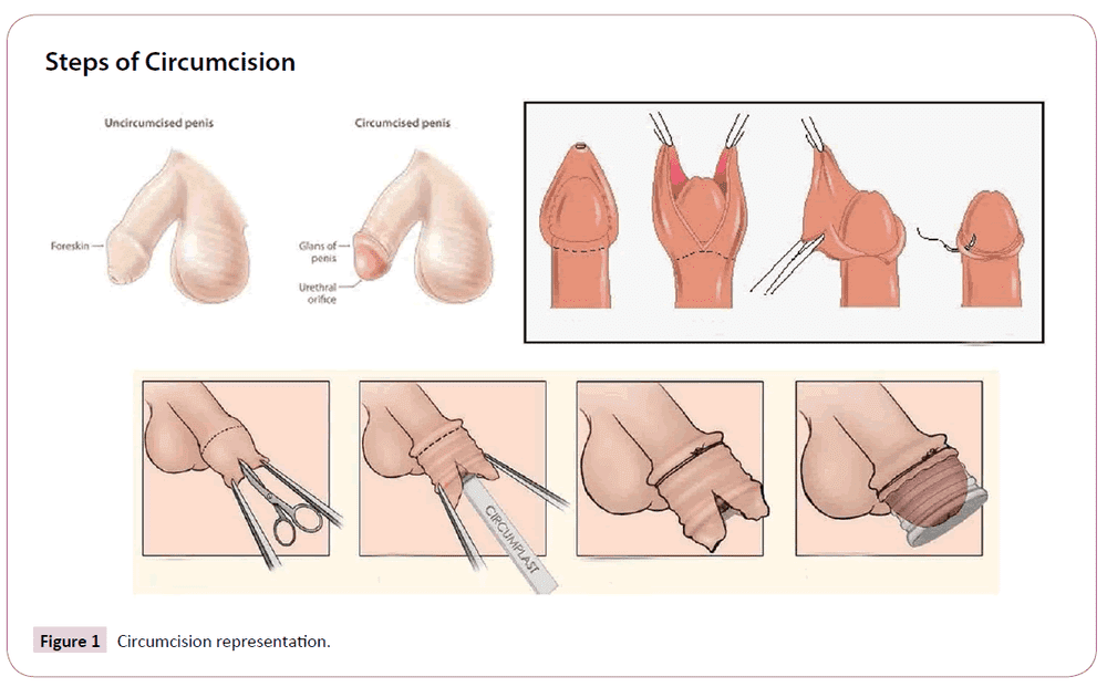 Contraceptive studies circumcision representation 2 2 9 g001