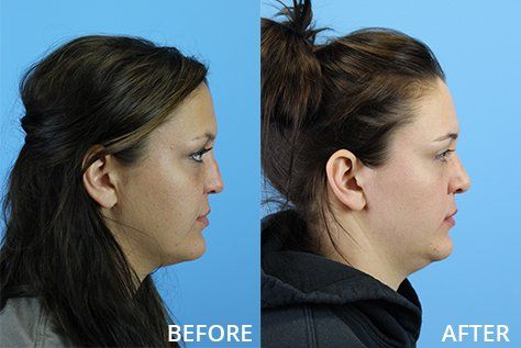 81B98A1F 784F 4EFC BB28 86F3B526110A