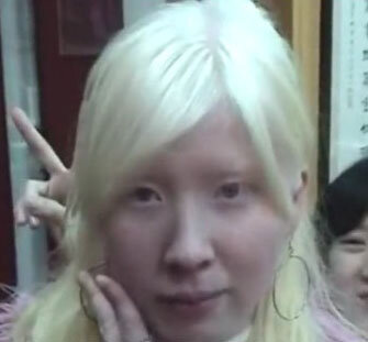 cute_albino_asian_girl.jpg