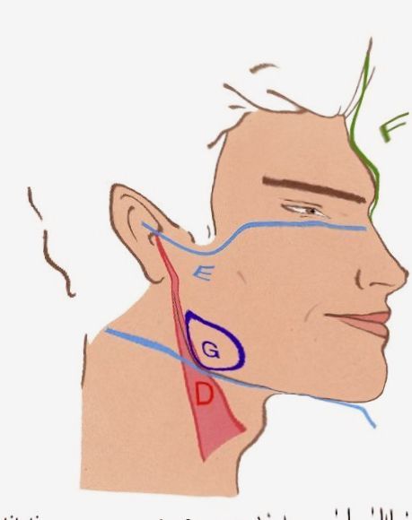 PSFix 20191101 051122