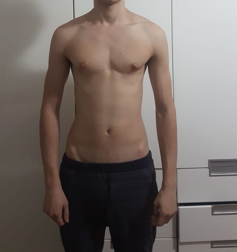 Afterbelt