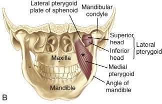 3 s20 B9780323045834000060 f006 019b 9780323045834