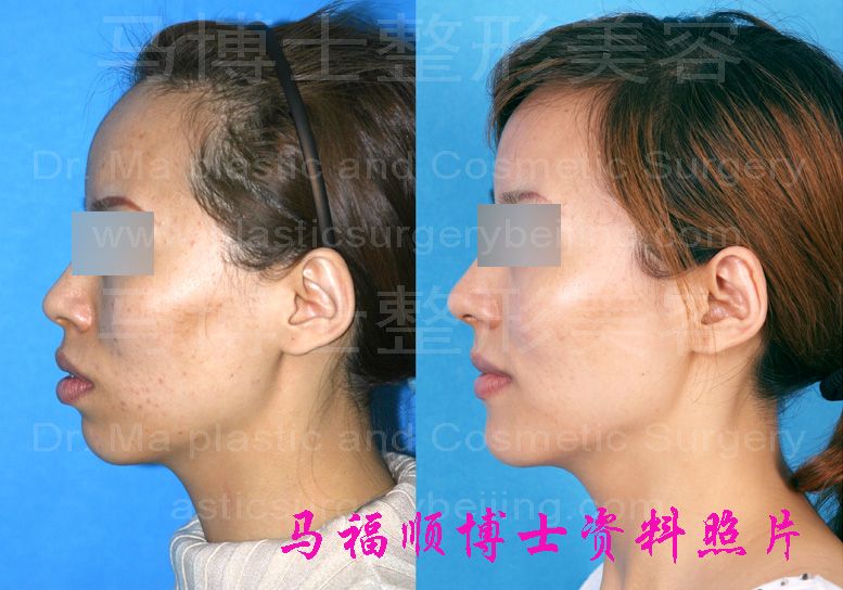 AB08DBF9 5F49 4AC0 B56F DC8C5530B058