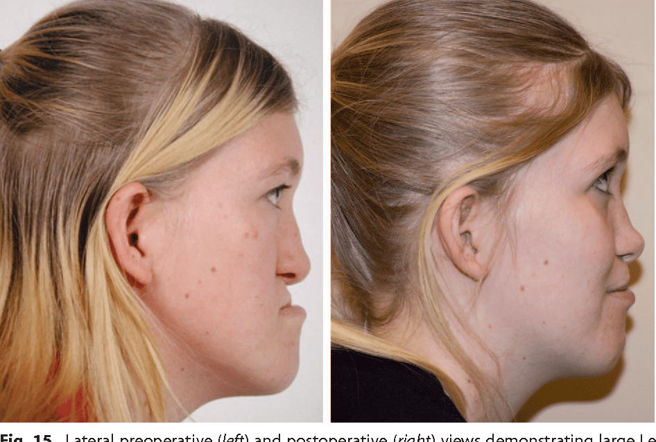 11 Figure15 1