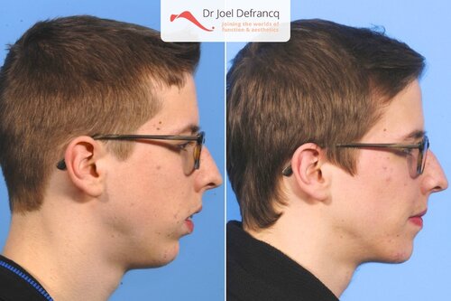 Dr Joel Defrancq 1456571001093015200 4051
