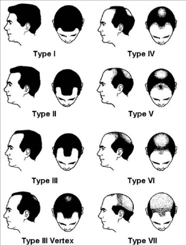 1575224701676