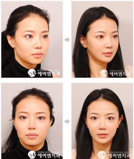 A779BDD2 3BCE 420B 8CC0 E0B59C90E659