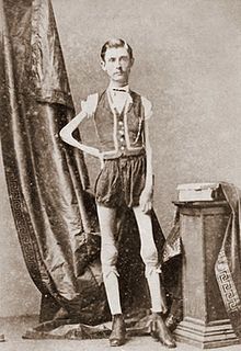 220px Isaac W Sprague living skeleton 1867