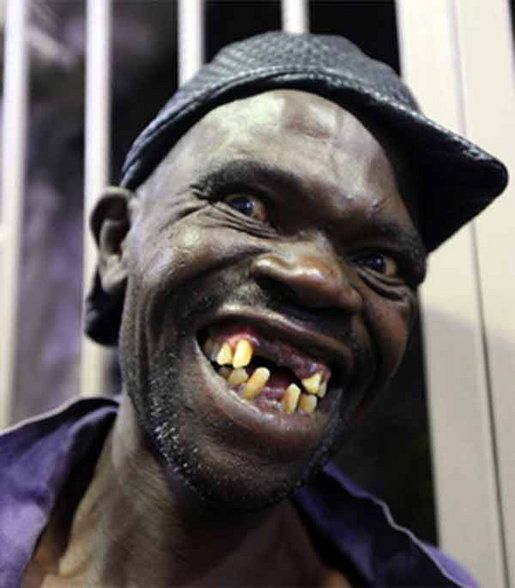 Pictures Of 10 Of The Worlds Ugliest People Which Are Truly Not A Treat For Our Eyes 5