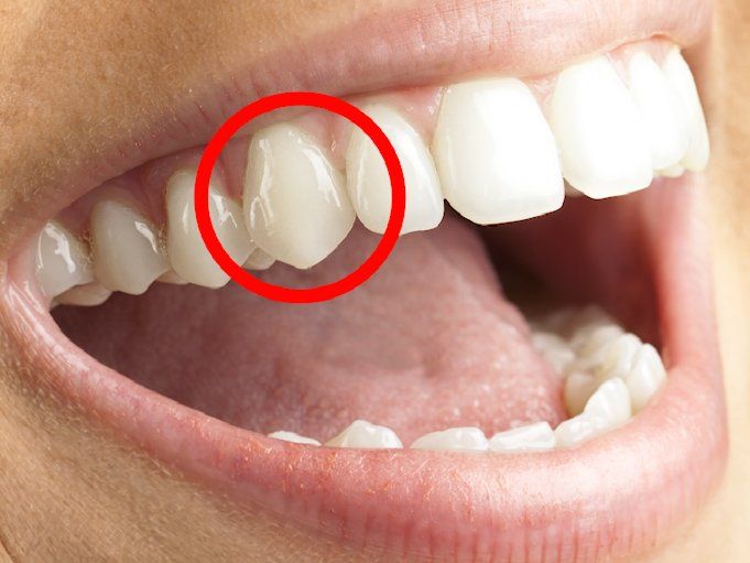 008ABAA1 1EBD 4D7C 9B78 204425D8BB54