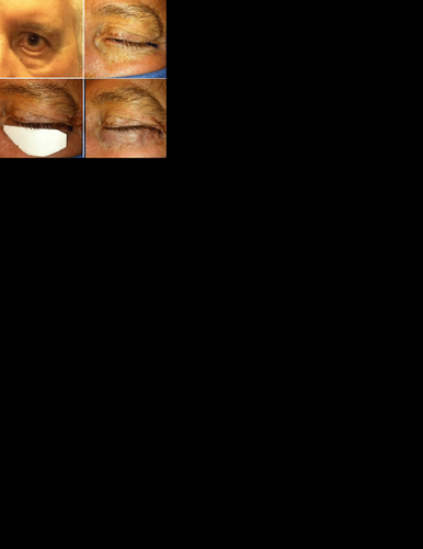 2DF24EAC-66A5-42A6-ADA6-515704DE940A.png