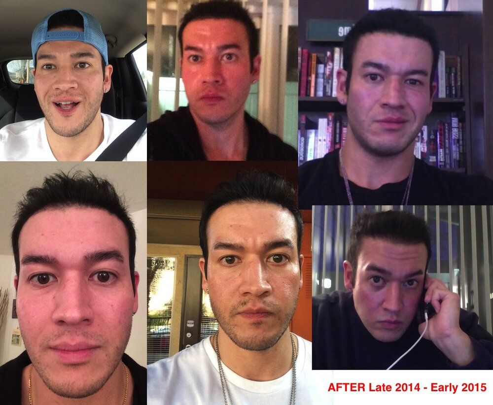 looksmax ghk cu Great collagen ascension | Looksmax.org