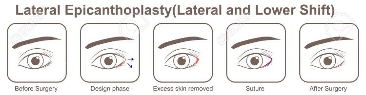 1CE17790 B28D 4D50 B71A 21915BCE280A