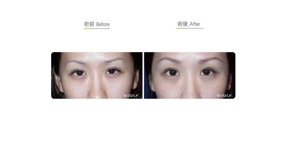 FDA788F1 4B11 42BE ADC7 CF93E7F28923