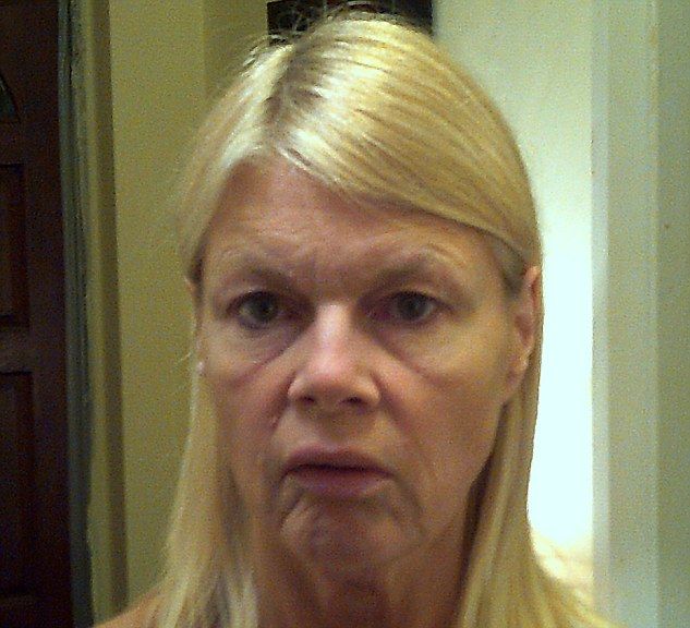 22E04E8D00000578 3004027 The downside of weight loss Karen the day before her face lift a m 4 