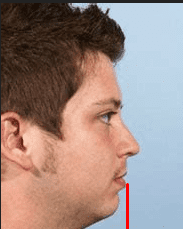 How to tell if you have a recessed chin | Looksmax.org - Men's Self ...