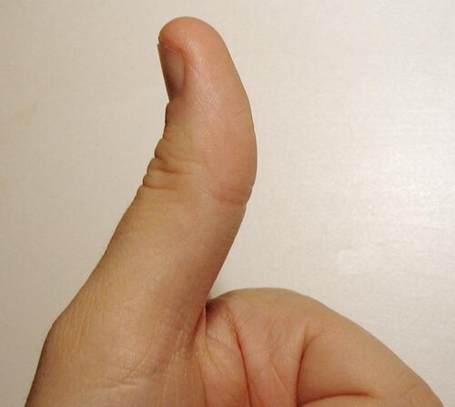 Thumbup.jpg