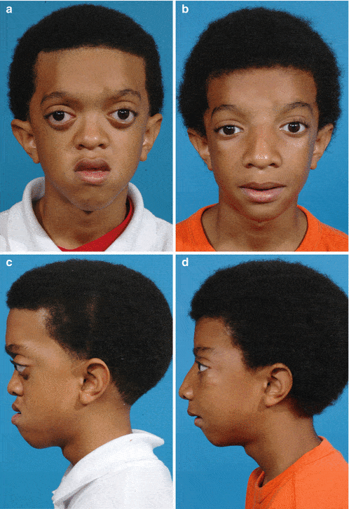 31FBB36D 3A45 4E37 9592 4950A871B83D