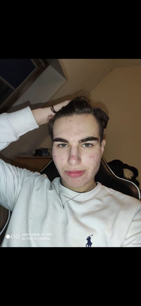Tan1 Tan1
