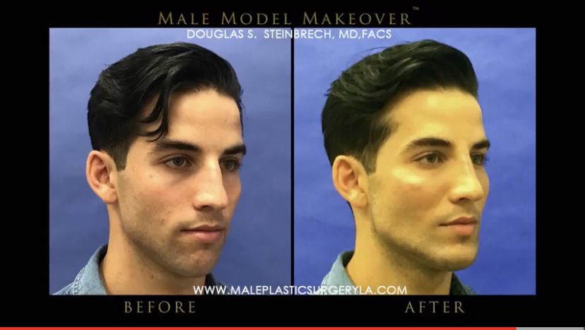 FEAC524B AAF9 4E88 8EC2 5BAE891DDF54