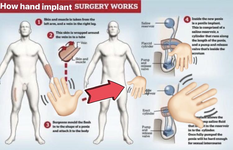 52EC7917 E53B 4AEC 949F 281175F2904C