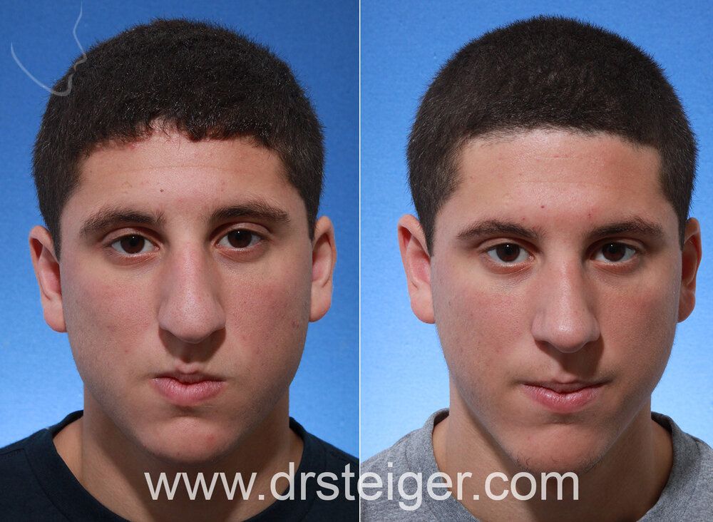 0079AC92 1B49 42C7 A653 F2780C96601C