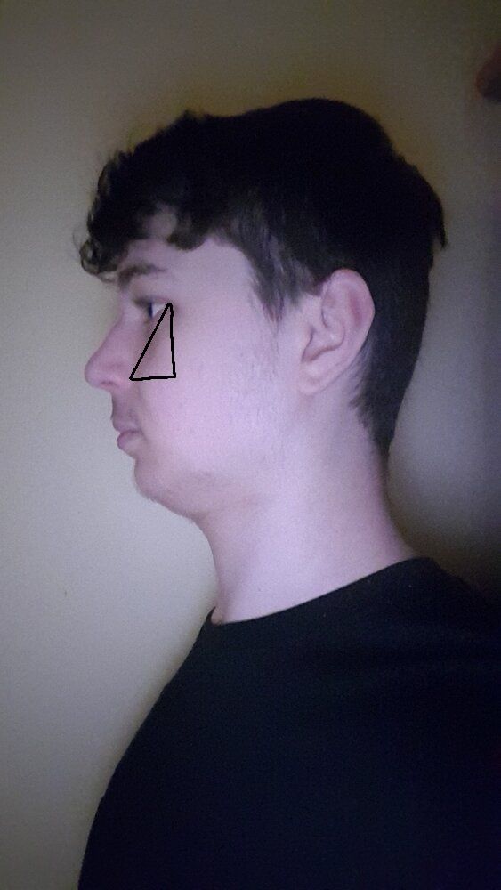 Right side profile