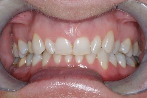 BE0299D0 5410 47B2 AFD3 26170CBD3191