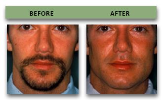 26EAE452 23EE 4C19 B088 AAC15B5812B7