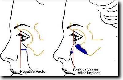 Images 34