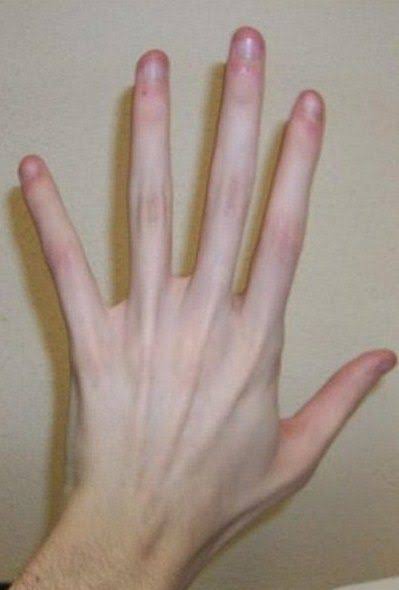 Images 38