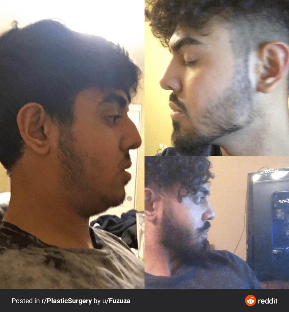 77d8ee9 1