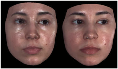 homeoblock facial changes.jpg