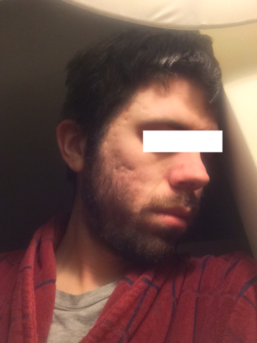 before1.png