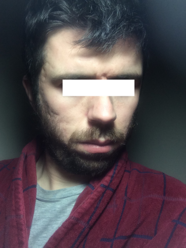 before4.png
