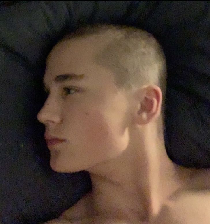 Bald kid