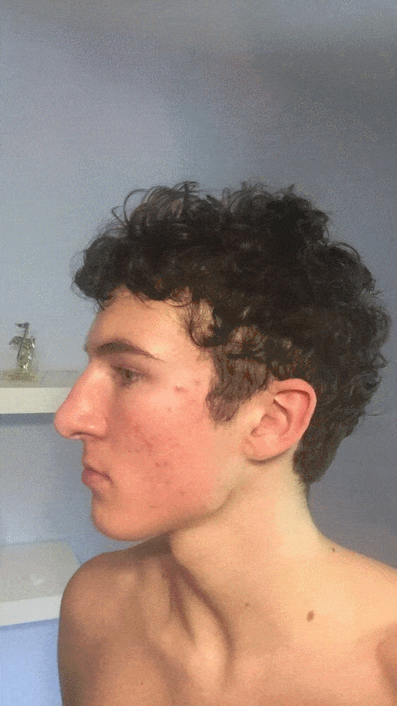 Nosecel